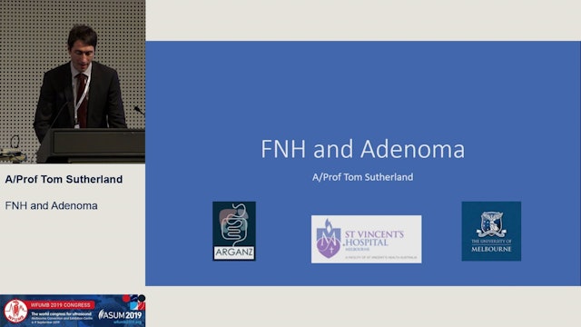 FNH and Adenoma: an update