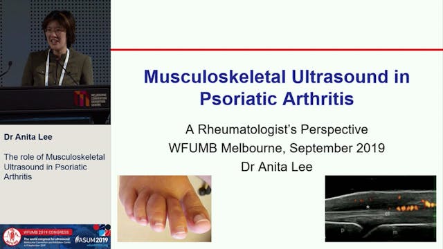 The role of musculoskeletal ultrasoun...