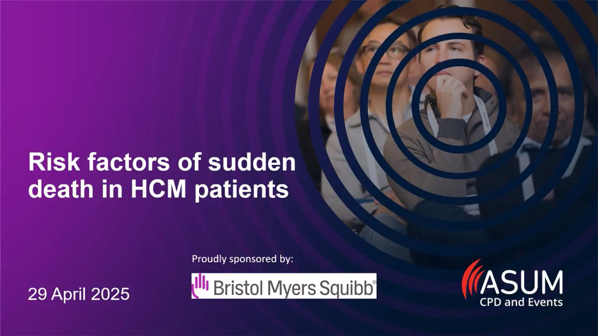 Risk factors of sudden death in HCM patients