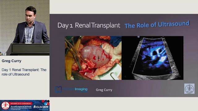 The day one renal transplant: US diag...