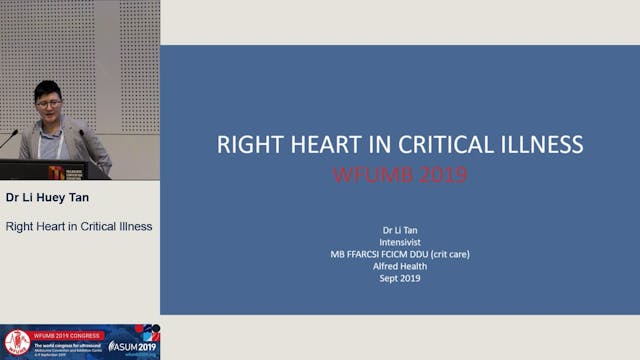 Right heart in critical illness