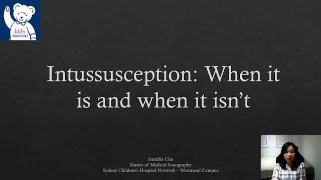 Intussusception When it is and when it isn't