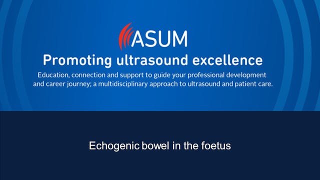 Echogenic bowel in the foetus