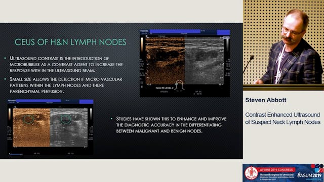 Contrast enhanced ultrasound in head ...