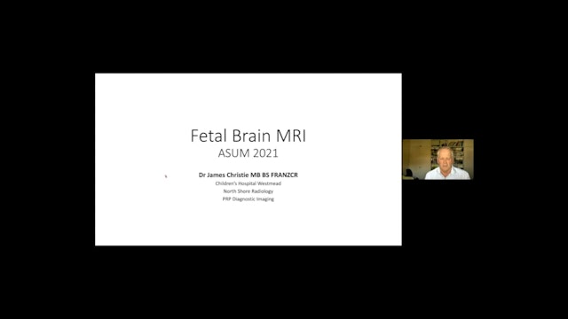 Fetal Brain MRI