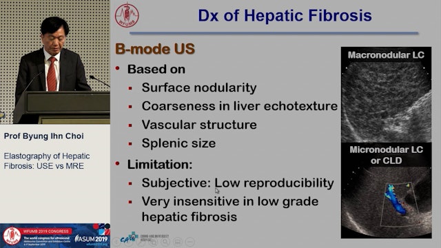 Hepatic fibrosis: US elastography vs. MR elastography