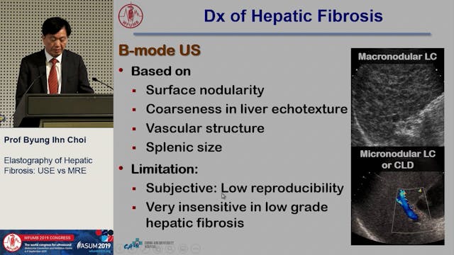 Hepatic fibrosis: US elastography vs....