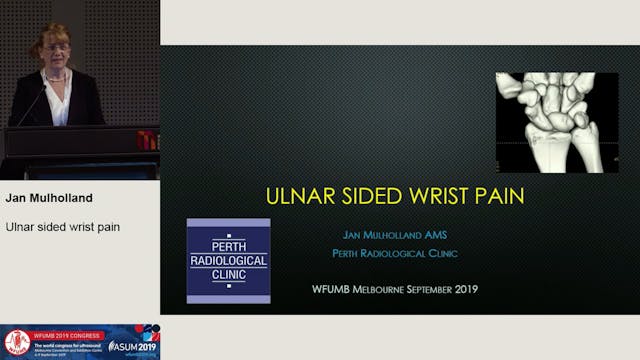 Ulnar sided wrist pain