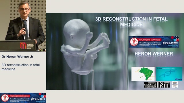 3D reconstruction in fetal medicine