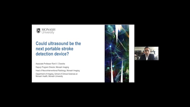 Could ultrasound be the next portable stroke detection device?