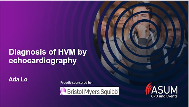 Diagnosis of HCM by echocardiography