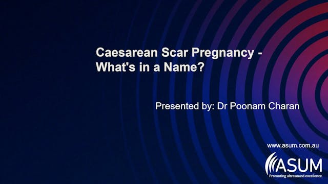 Caesarean Scar Pregnancy - What's in ...