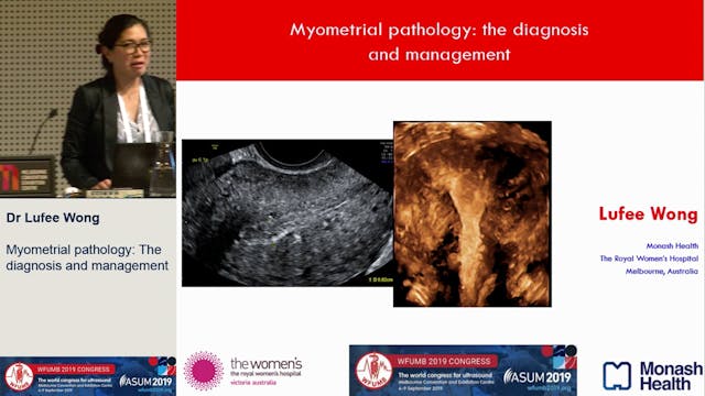 Myometrial pathology: The diagnosis a...
