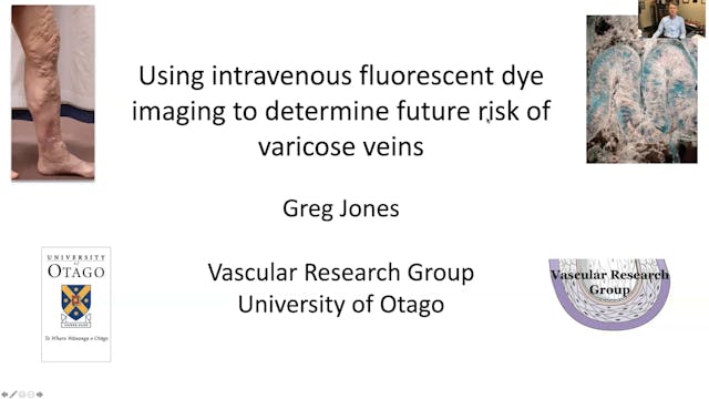 Using intravenous fluorescent dye to ...