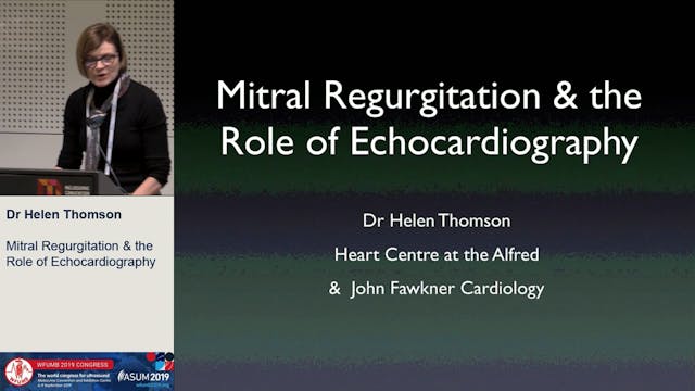 Mitral regurgitation