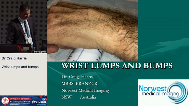 Wrist lumps and bumps