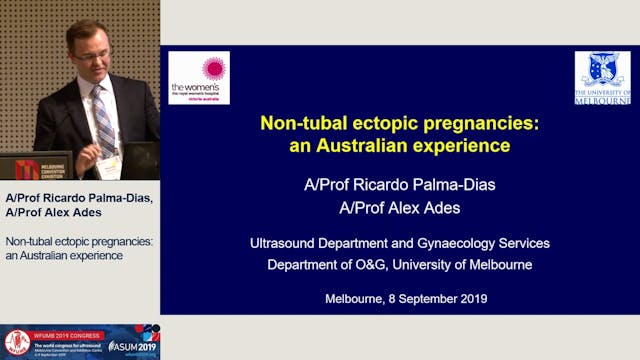 Non-tubal ectopic pregnancies: an Aus...