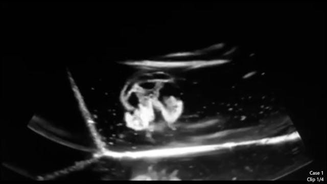 03-Test_Case1_1.4