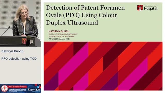 Patent Foramen Ovale detection using TCD