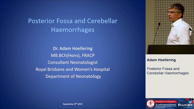 Posterior Fossa and Cerebellar Haemorrhages