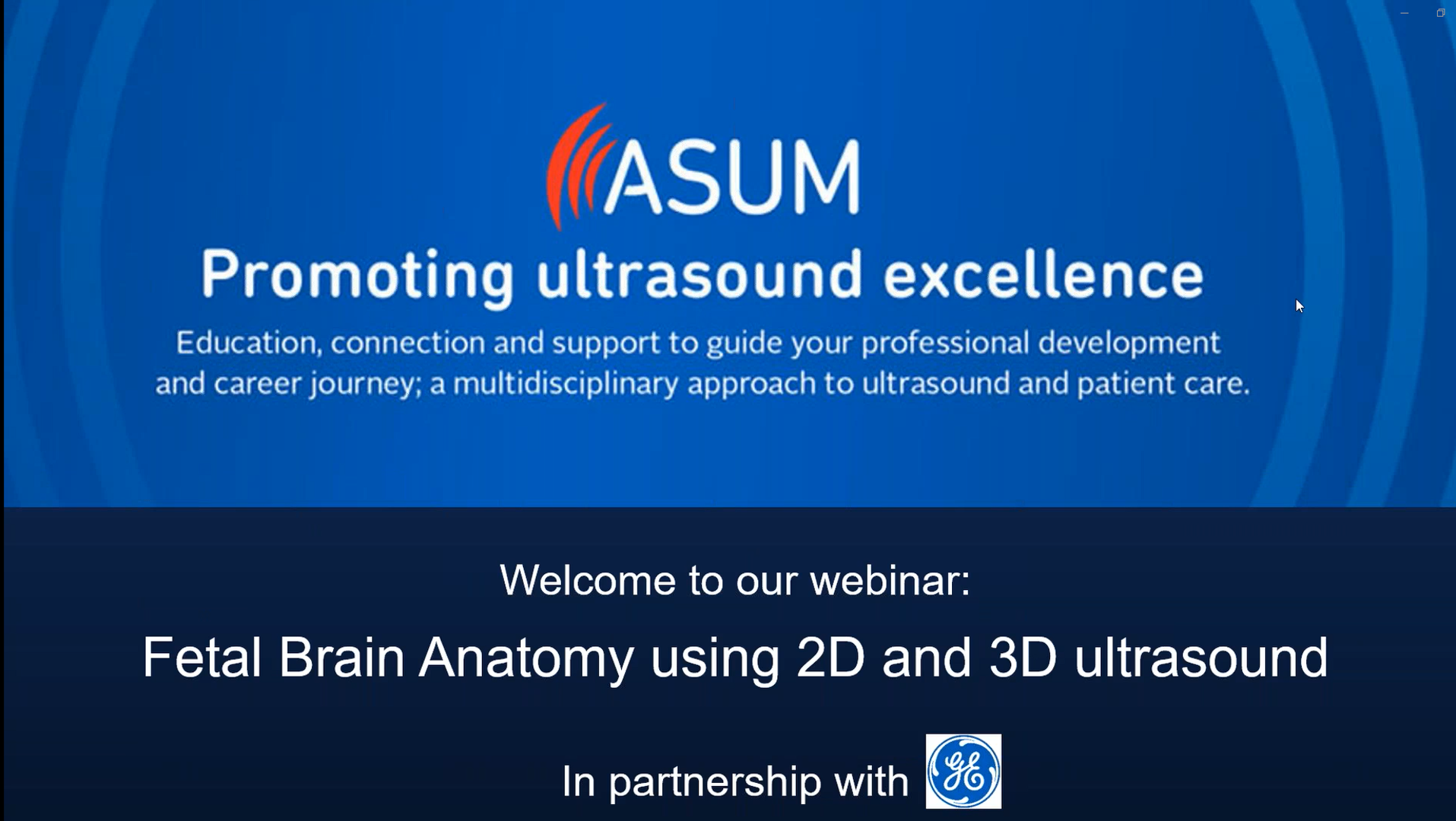Fetal Brain Anatomy using 2D and 3D ultrasound