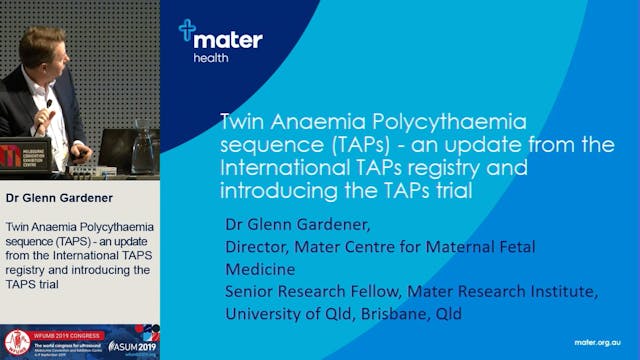 Twin Anaemia Polycythaemia Sequence (...