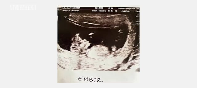 The Baby Ember Story: Embracing Life ...