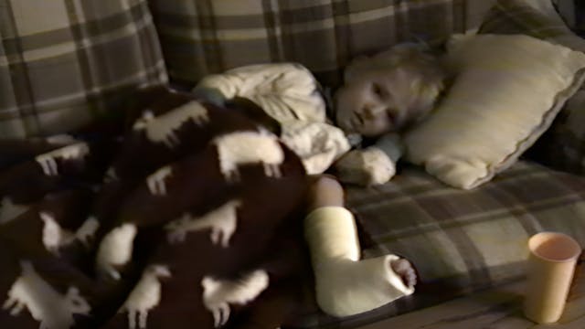 Nathan's Broken Leg