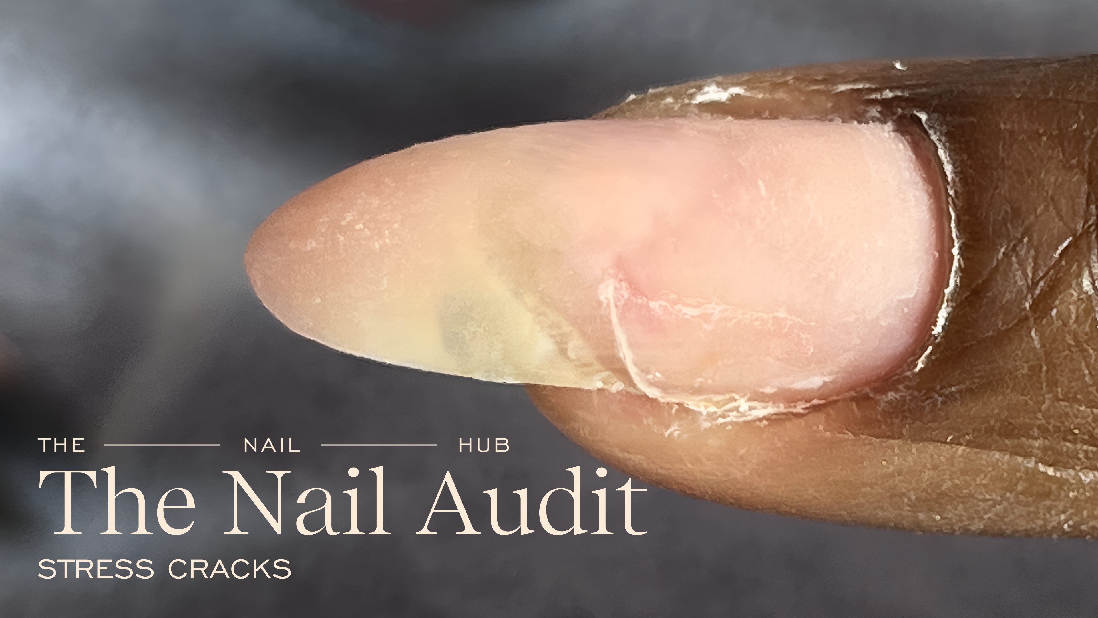 Stress Breaks & Cracks