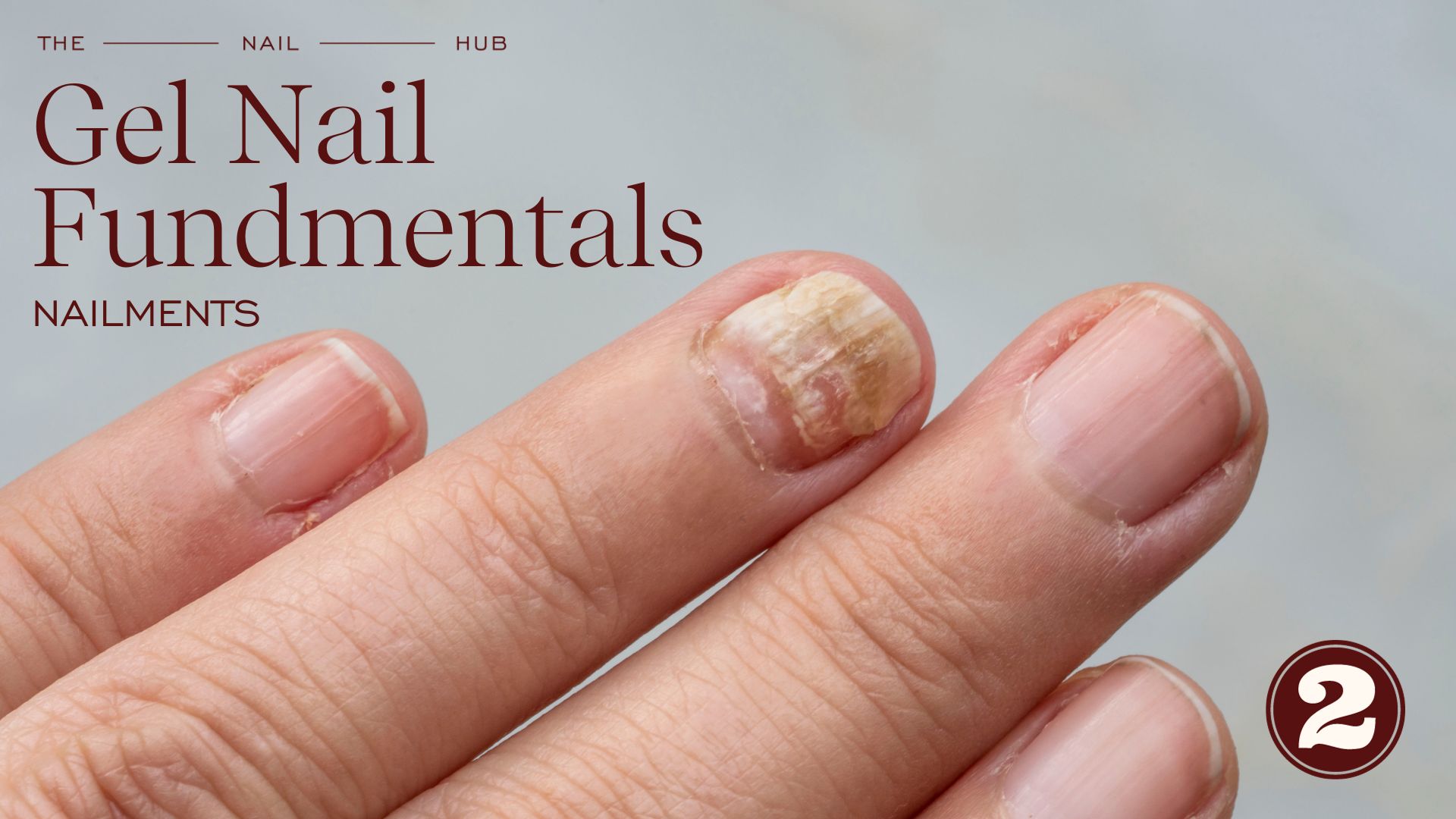 Nailments