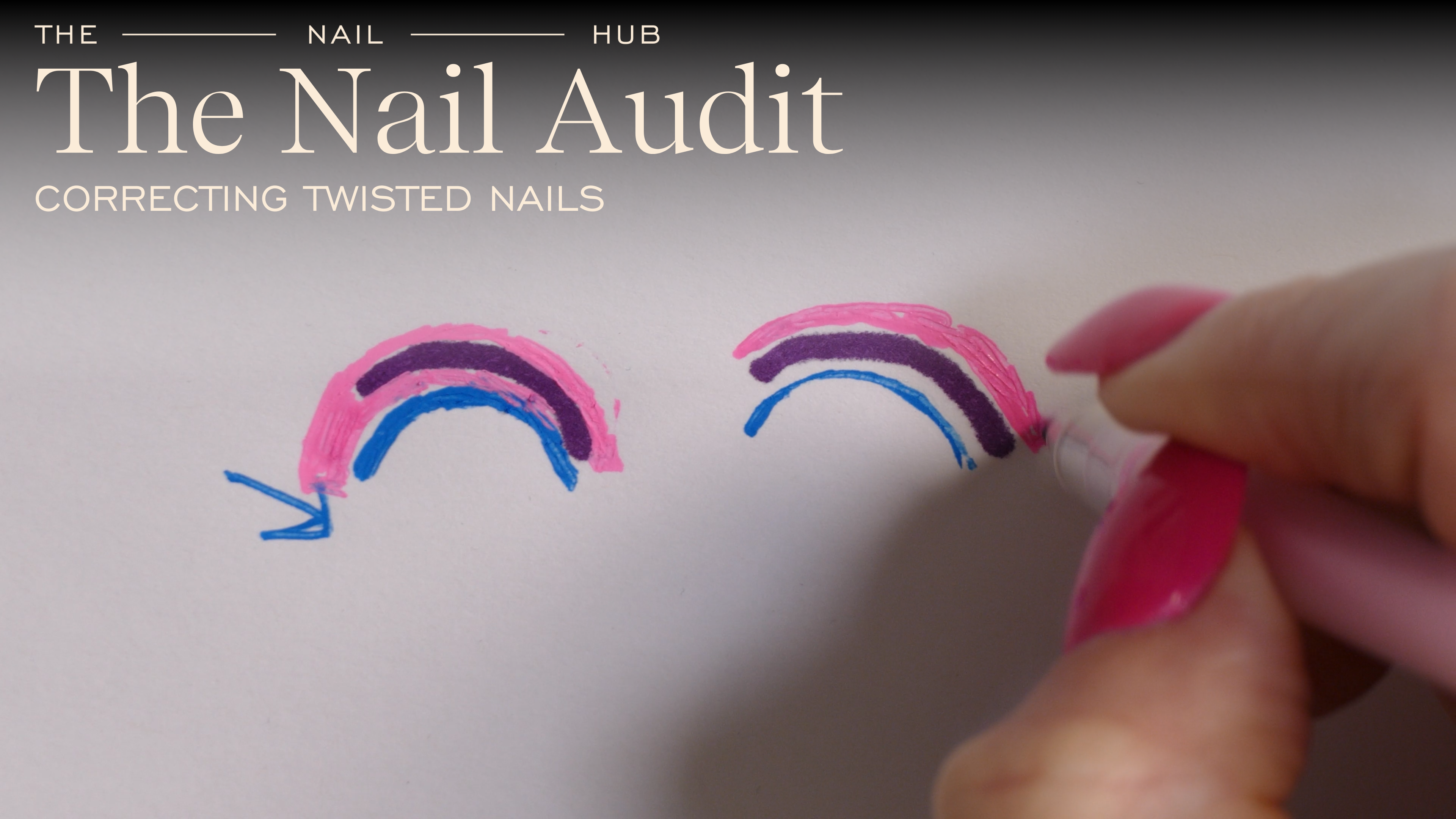Correcting Twisted Nails