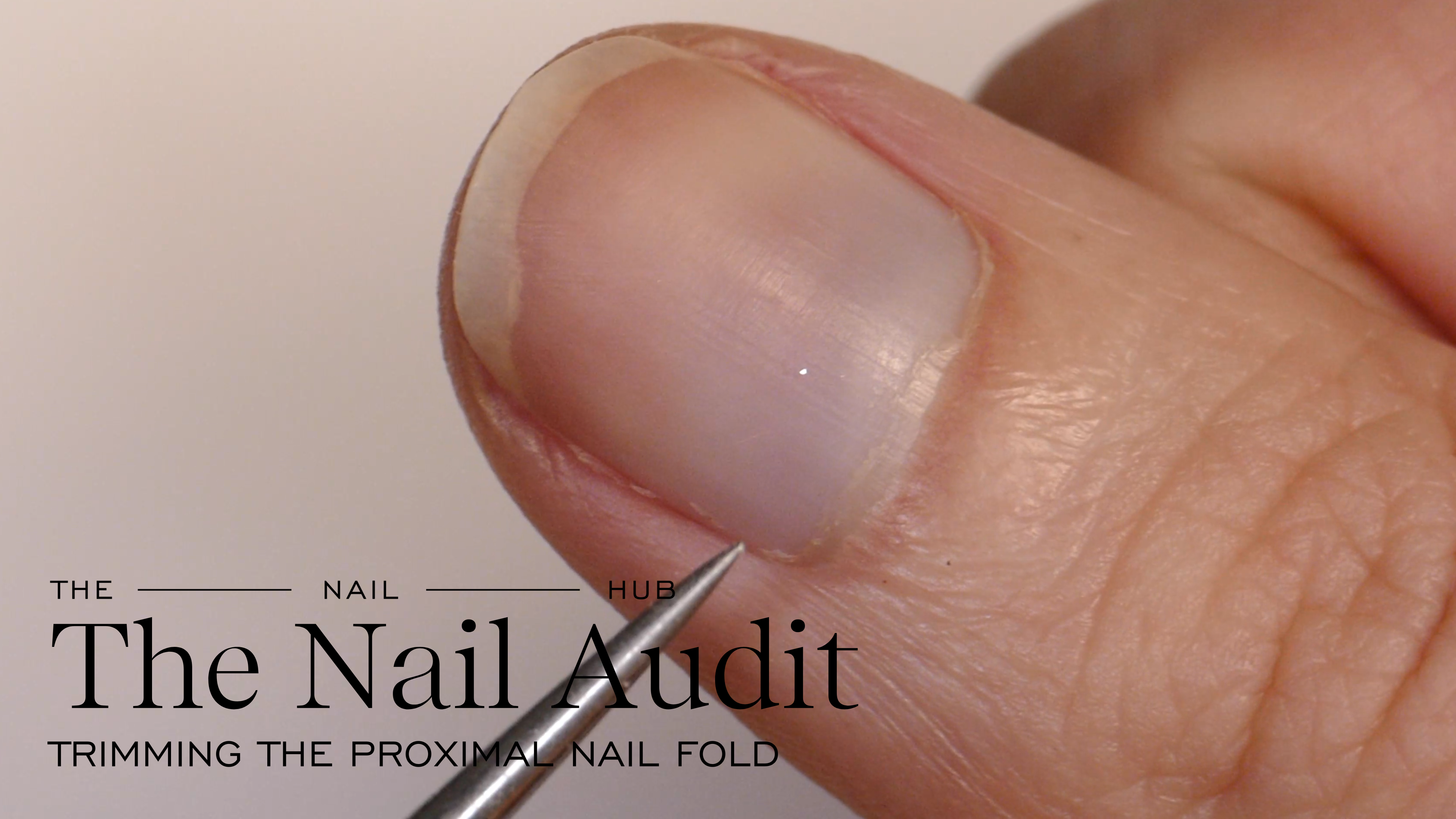 Proximal Nail Fold