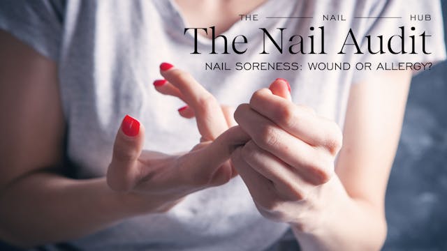Nail Soreness: Wound or Allergy?