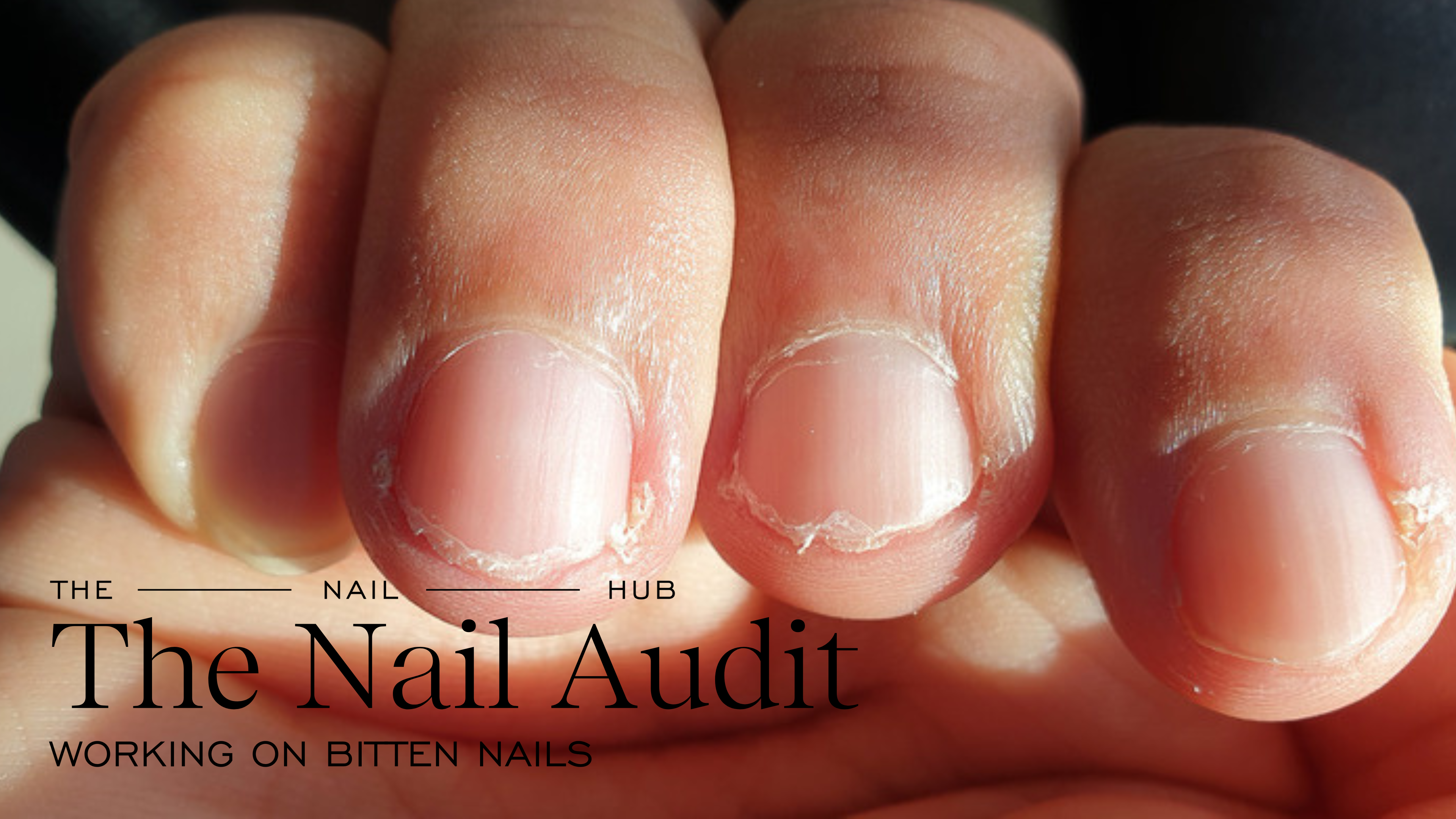 How To Extend Bitten Nails