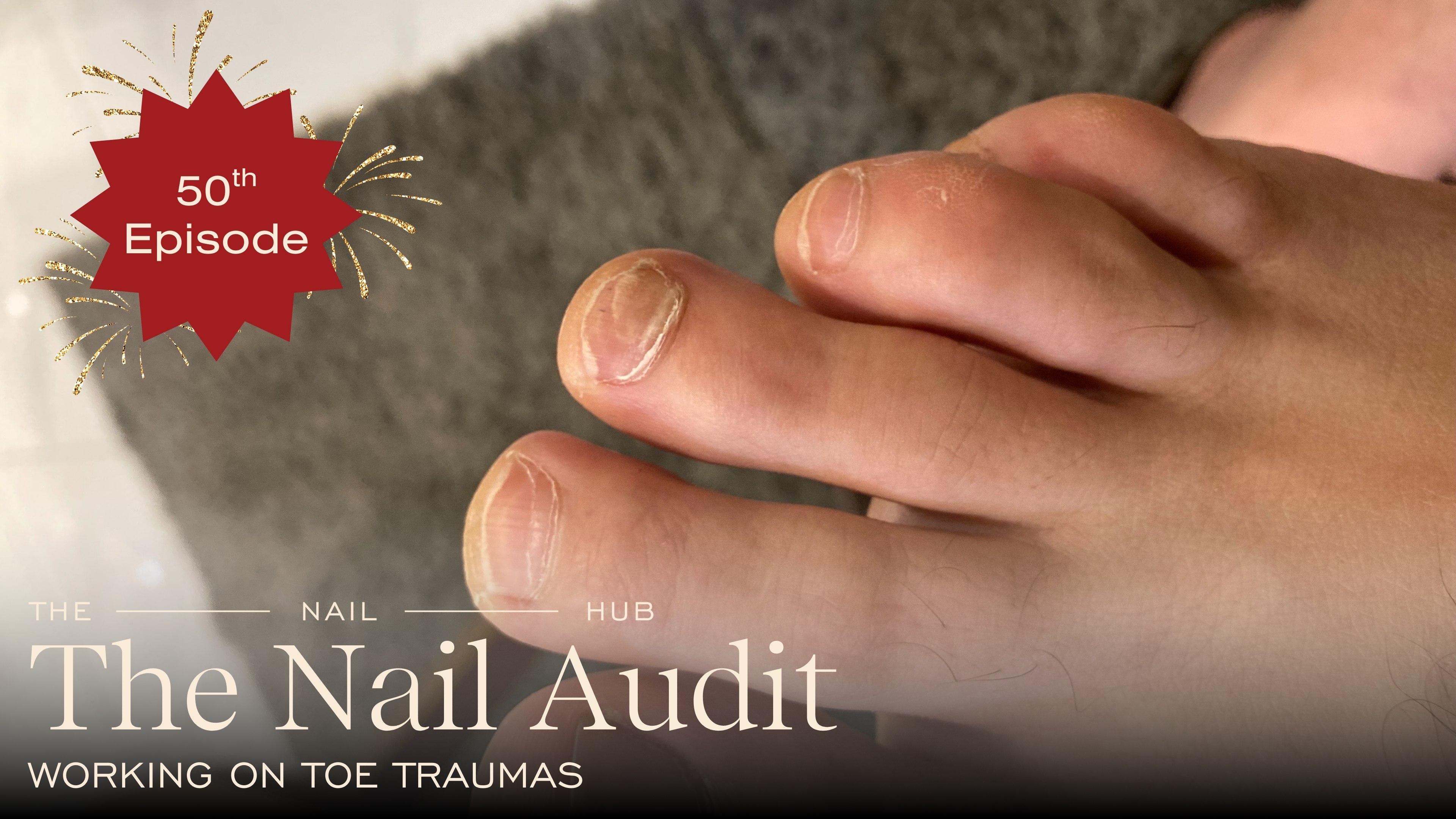 Working on Toes Traumas