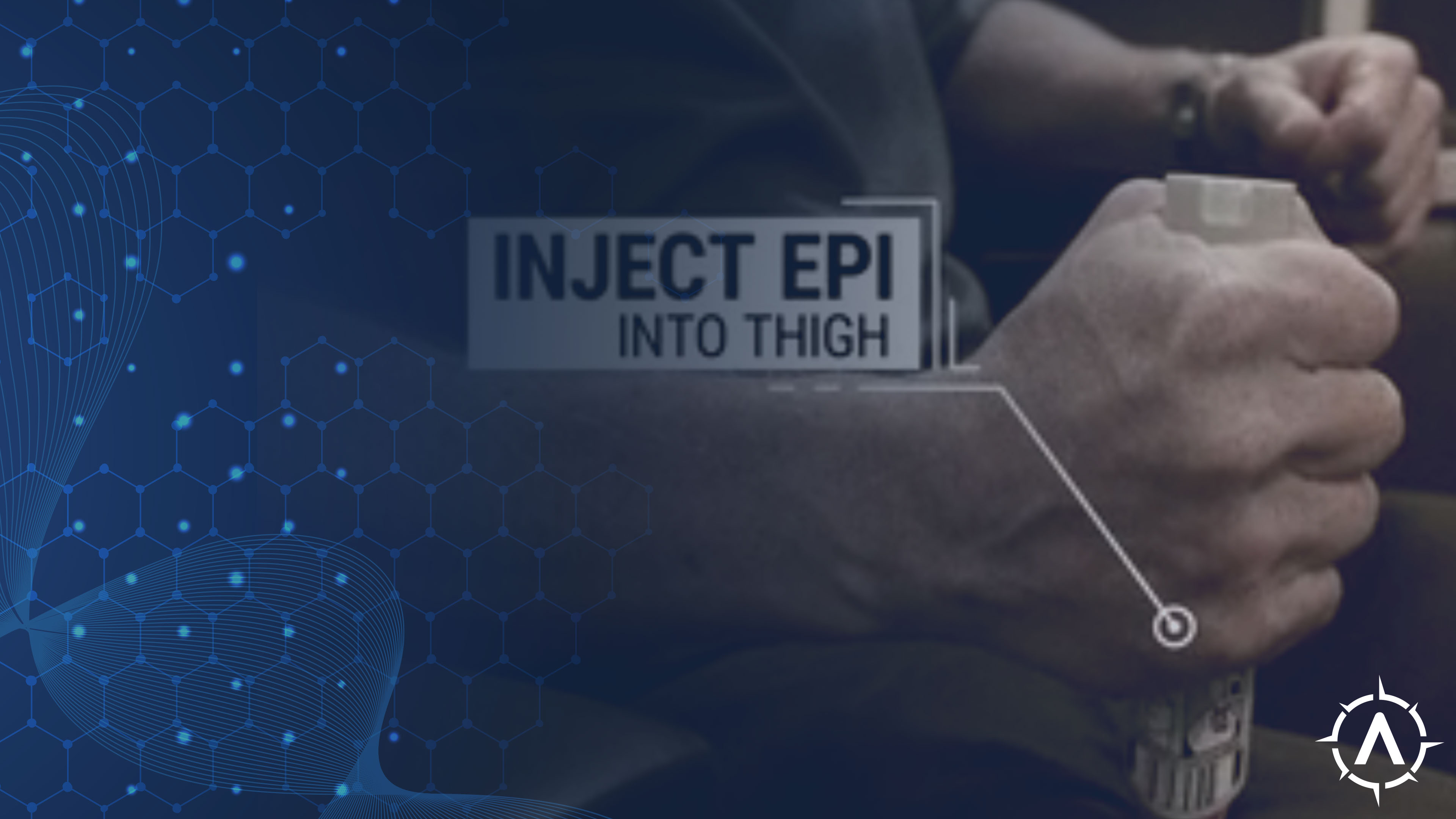 Medical Incidents: Treating Allergic Reactions