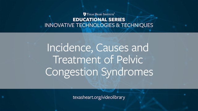 Incidence, Causes and Treatment of Pelvic Congestion Syndromes (0.50)