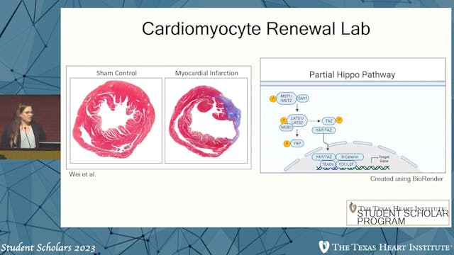 Ruby Wilson | Cardiomyocyte Renewal Lab