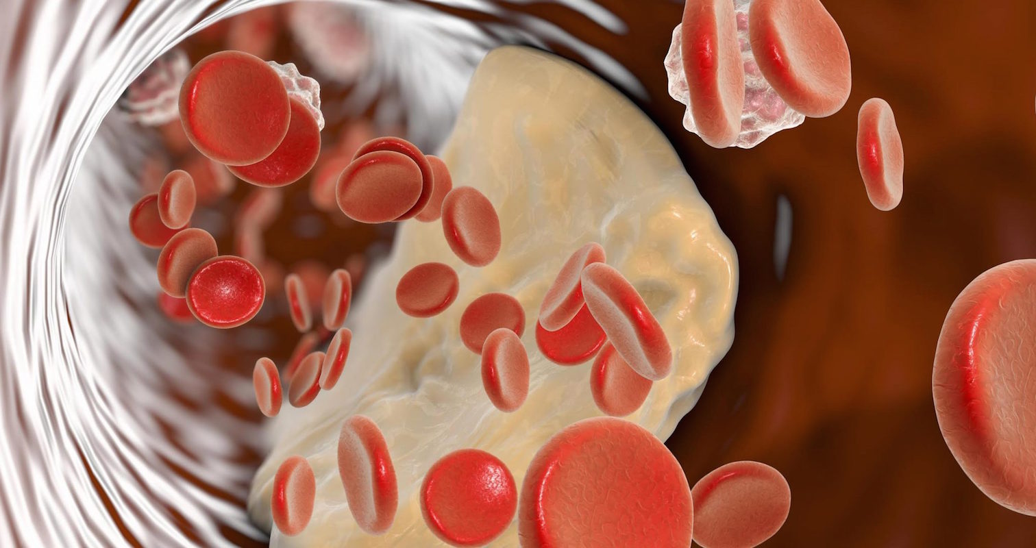 Educación del paciente