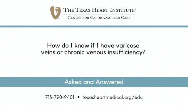 How do I know if I have varicose vein...