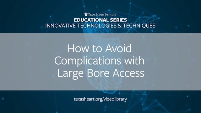 How to Avoid Complications with Large...