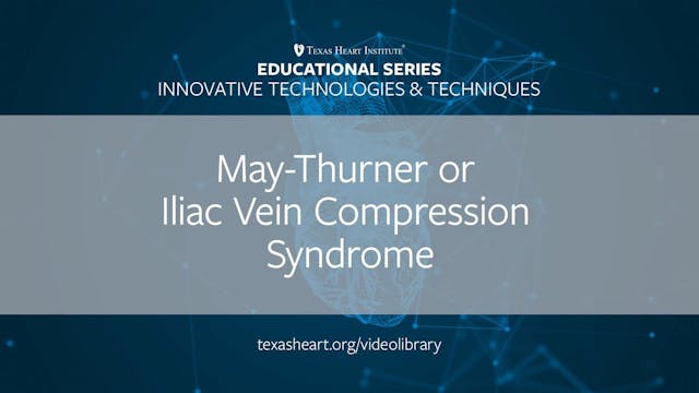 May-Thurner or Iliac Vein Compression...
