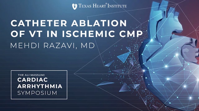 Catheter Ablation of VT in Ischemic CMP