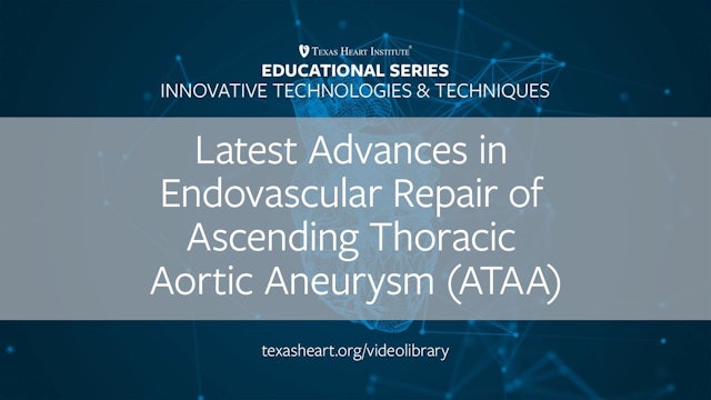 Latest Advances in Endo Repair of Ascending Thoracic Aortic Aneurysm (0.50)