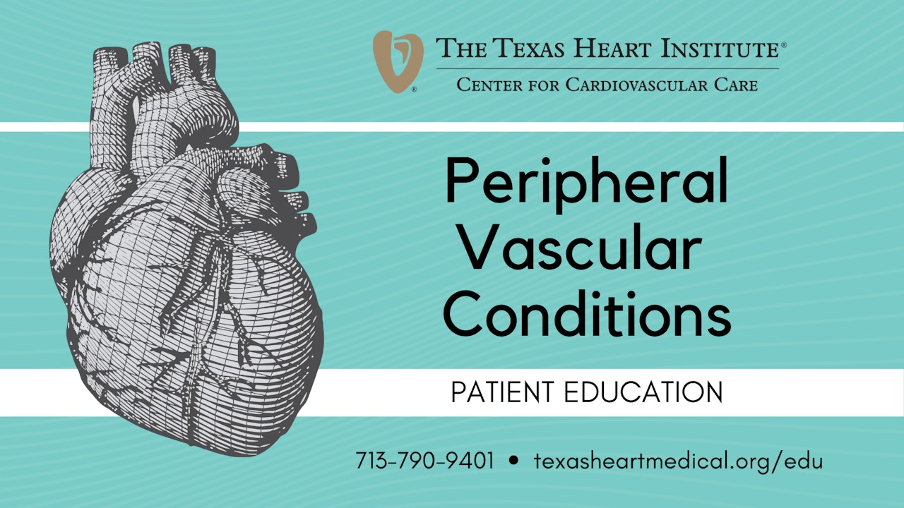 Peripheral Vascular Education