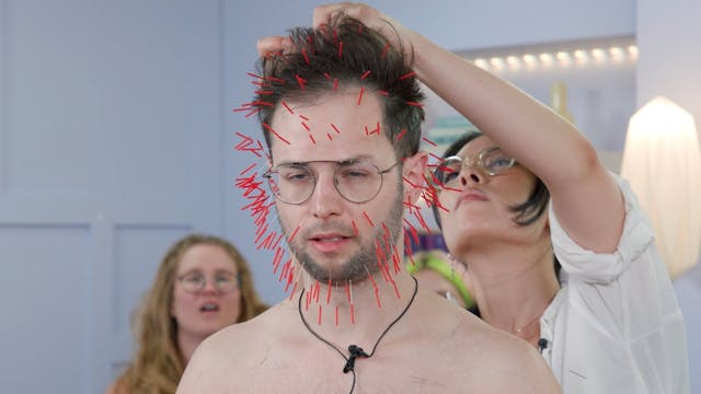 Zach Tries 1000 Needle Acupuncture