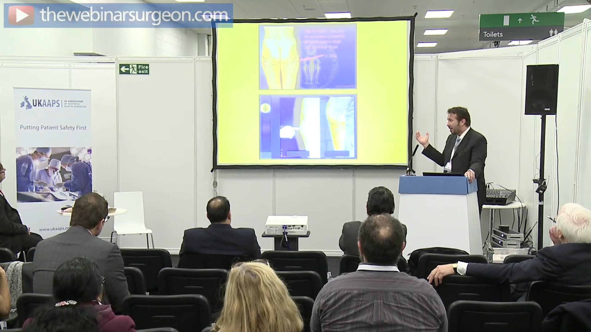 Lipoplasty – Get the Best Results, Riccardo Frati