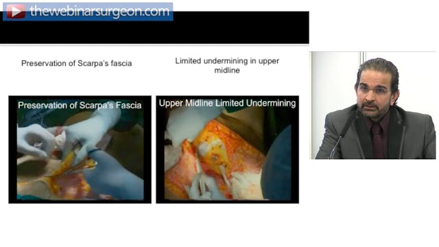 Aesthetic Surgery of the Obese, S Vad...