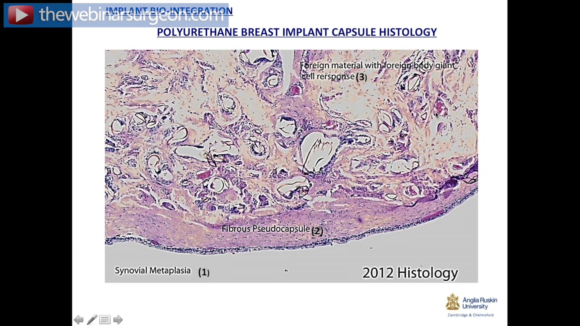 Histological Bio-integration of Polyurethane, J Frame