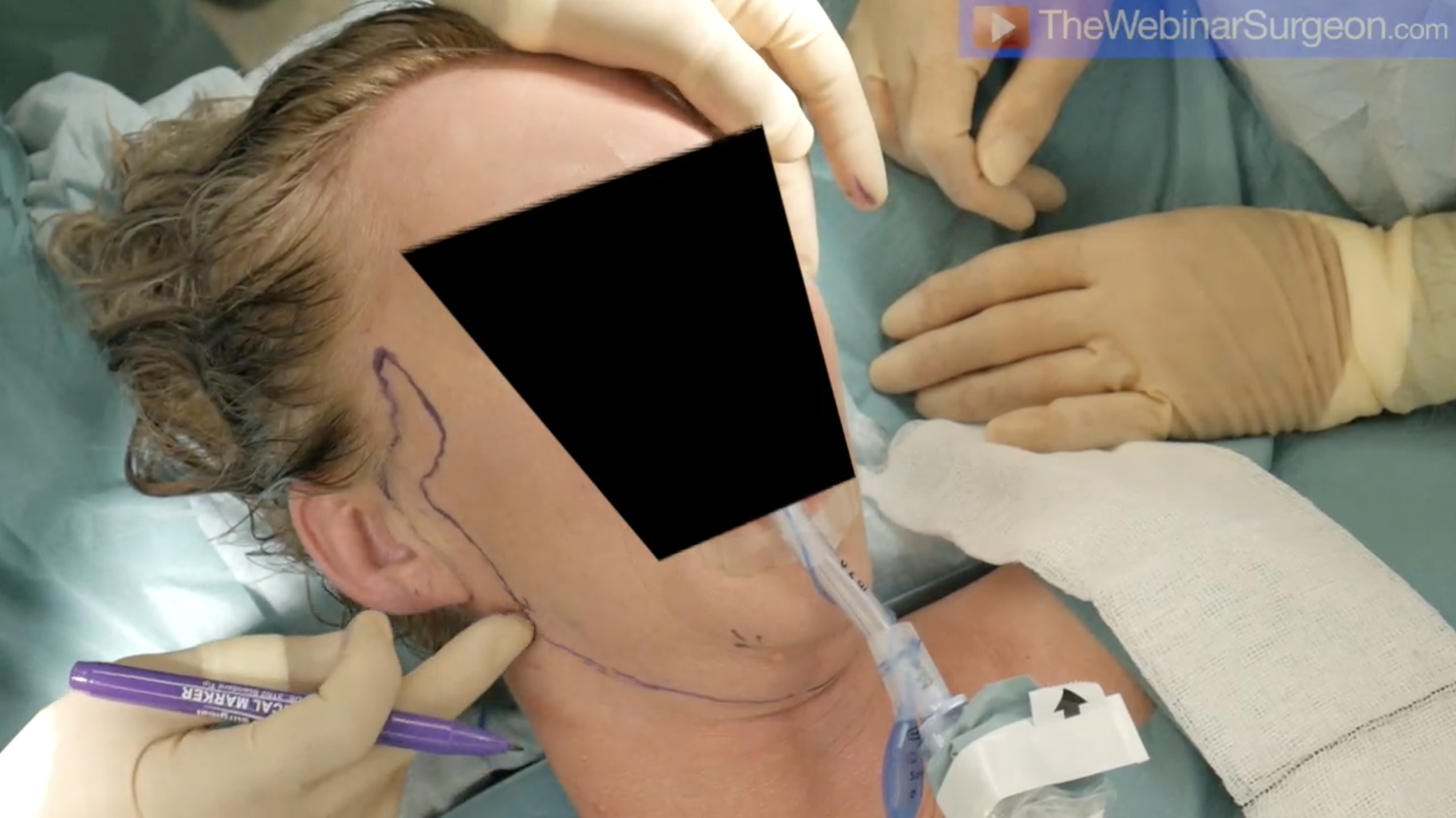 The 'R' Facelift by Mr Muhammad Riaz